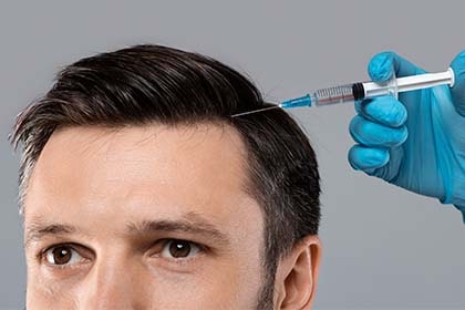 Injections de PRP contre la Perte de Cheveux à La Rochelle